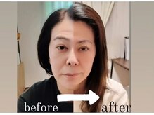 リラックスできる個室空間で、本格的な施術を受けられます。