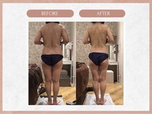 ソウイボディ 武蔵小杉店(Sou-i body)/お客様before→after