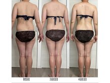 ヨルエステ(yoru aesthe)/【痩身、燃焼ケア】