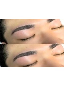 メンズフェイシャル