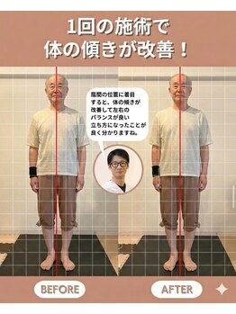 のなか整体院/整体 Before→After