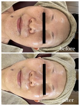 ジャスミン(Jasmin)/エステティック×シェービング