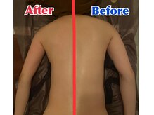 チル 渋谷店(CHILL)/ビフォアアフター