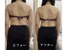 メリアミーゴ(Meli amigo)/肩凝り・頭痛改善