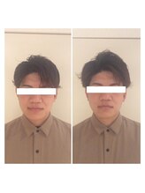 癒し～ぷ 熊本店/男性の方にも♪【小顔矯正】