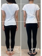 ホリック アイス コア ボディ(HOLIC ICE CORE BODY)/お客様ビフォーアフター３