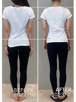 ホリック アイス コア ボディ(HOLIC ICE CORE BODY)/お客様ビフォーアフター３