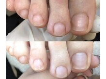 プロティア(PROTEA)の雰囲気（フットケアで嫌な臭いも角質もすっきり【¥4,400】）
