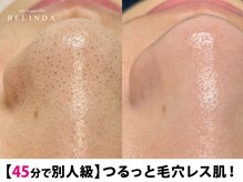 ベリンダ(BELINDA)
