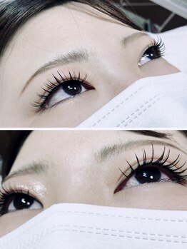 モモンウールーの写真/持続力◎オトナ女性に大人気★《LEDフラットラッシュ》アンドヘルシーでパッチリ美しいお目元に♪