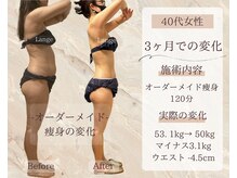 サロン ド ボーテ ラーンジュ 岐阜店(salon de beaut'e L'ange)/ハイパ-ナイフEX2ダイエット痩身