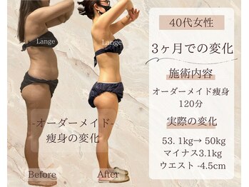 サロン ド ボーテ ラーンジュ 岐阜店(salon de beaut'e L'ange)/ハイパ-ナイフEX2ダイエット痩身