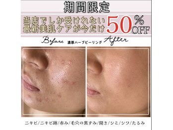 アリュール 倉敷(ALLURE)の写真/《人気No.1の肌質改善メニューが今だけ50%OFF》肌に優しい濃厚ハーブで素肌の内側から改善◎化粧ノリも抜群