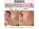 アリュール 倉敷(ALLURE)の写真/《人気No.1の肌質改善メニューが今だけ50%OFF》肌に優しい濃厚ハーブで素肌の内側から改善◎化粧ノリも抜群