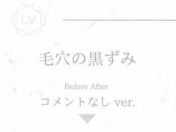 ラヴィオーラ 烏丸(LV)/ダイヤモンドハーブピーリング