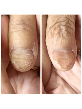 リネイル 長浜(Re-na-iL)の写真/【健康志向で自爪を大切に】ナチュラルな仕上がり◎悩みの多い爪もプロケアで健やかな美しさへ導きます！