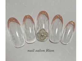 定額シンプルコース