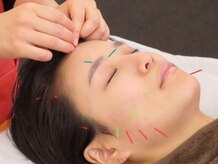 八軒さきがけ鍼灸整体院