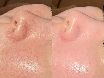 ルーナジェーナ(Luna llena)/池袋 エステ ルーナジェーナ