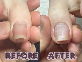 ポドロ ウィズ ニコルル 大阪天満店(PoDoLo with Nicolulu)/【巻き爪】フットケア大阪・梅田