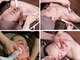 サロンドシェリ(Salon de cheri)の写真/【小顔＆美肌を同時に叶える贅沢サロン☆】顎下、お顔の術後ケアにも◎スッキリ美しいフェイスラインに☆