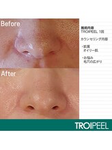 スキンラボアメリ(skin lab. ameri)/お悩み…毛穴テカリ