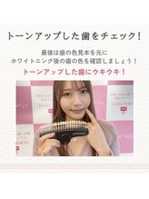 エクシアホワイトニング 津駅前店/10.歯の変化をチェック！