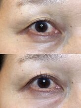 ダーム ド ローズ(Dame de rose)/【まぶたが上がるまつ毛パーマ】