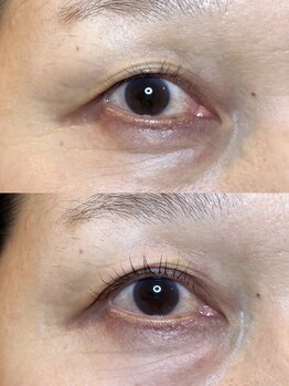 ダーム ド ローズ(Dame de rose)/【まぶたが上がるまつ毛パーマ】