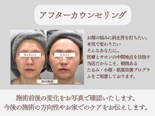 ジュジュ(juju)/アフターカウンセリング