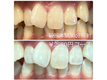 ホワイトニングルーム 横浜店(Whitening Room)/セルフホワイトニング/横浜