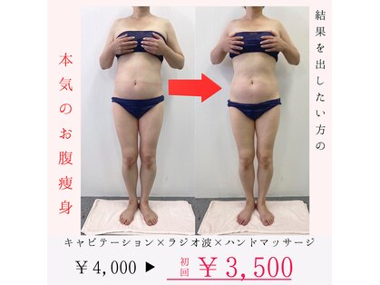 ムム(MooMoo)の写真