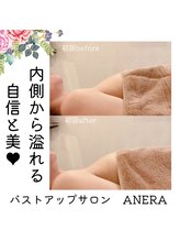 アネラ(ANERA) 心斎橋/30代２児のママ/産後萎縮悩み１