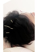 美巡究 南麻布/【四神総】百会の前後左右に1寸