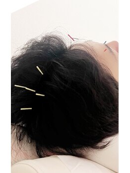 美巡究 南麻布/【四神総】百会の前後左右に1寸