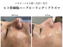 イロハ(IROHA)の雰囲気（メンズのお客様も大歓迎◎カップル/夫婦での来店も♪）