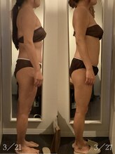 マロー(Mallow)/キャビテーションのビフォアフ