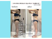 千歳の女神 三河安城店/【施術風景】Before/After