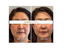ミトノウ(MITONOU)/お客様ビフォーアフター