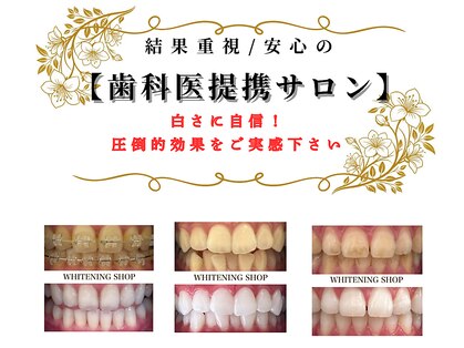 ホワイトニングショップ 妙高店(whiteningshop)の写真