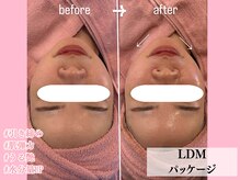 エンクリニカルラボ 京都駅前店(E&N CLINICAL LABO)/LDMパッケージ