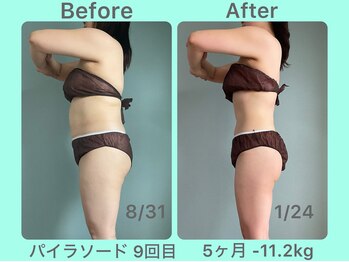 ビーナイス ビューティー(Be Nice Beauty)/30代 &nbsp;驚きくっきりBODYに大変身