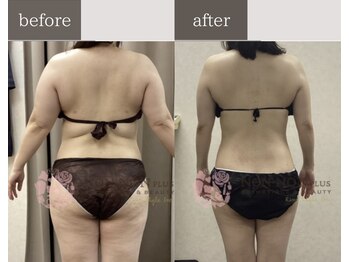 ノンノンプラス 博多(NON-NONプラス)/－20ｋｇ以上