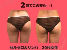 美方/マシーン&リンパで全身痩身に◎