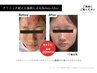 【1回で実感肌質改善！】エクソソーム導入フェイシャル 7,000円 /1回☆