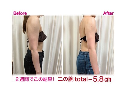 メイ(Mey)の写真