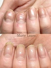マリーロール 梅田店(Marie Laure)/自爪育成/深爪矯正/ネイルケア