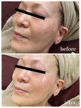 ジャスミン(Jasmin)/エステティック×シェービング