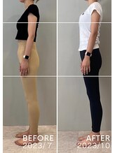 ホリック アイス コア ボディ(HOLIC ICE CORE BODY)/お客様ビフォーアフター5
