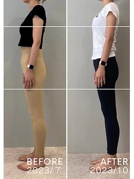ホリック アイス コア ボディ(HOLIC ICE CORE BODY)/お客様ビフォーアフター5